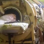The Last Iron Lung User